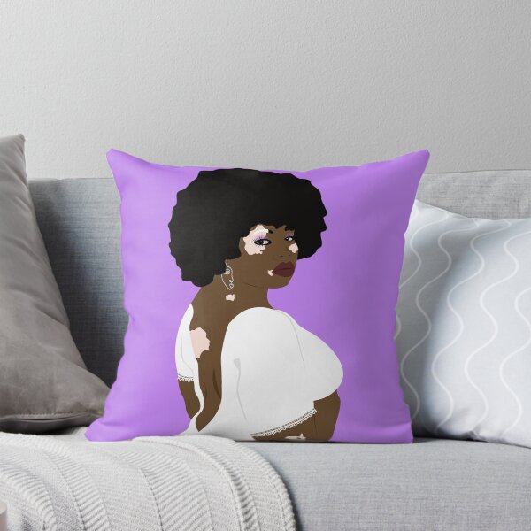 Item preview, Vitiligo beauty designed and sold by Tata-Boubou.