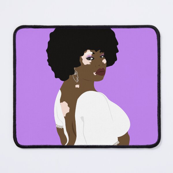 Item preview, Vitiligo beauty designed and sold by Tata-Boubou.