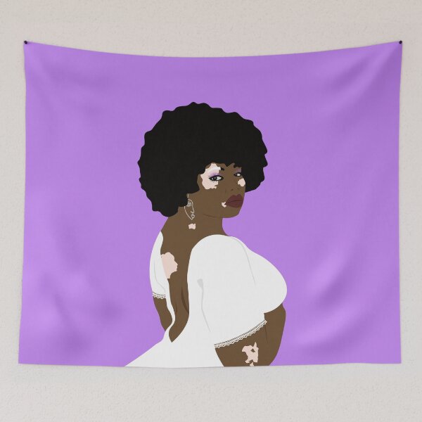 Item preview, Vitiligo beauty designed and sold by Tata-Boubou.