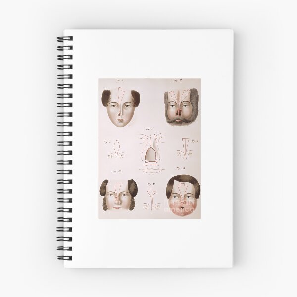 Item preview, nose reconstruction 1815 medical text science source designed and sold by intoreartenss.
