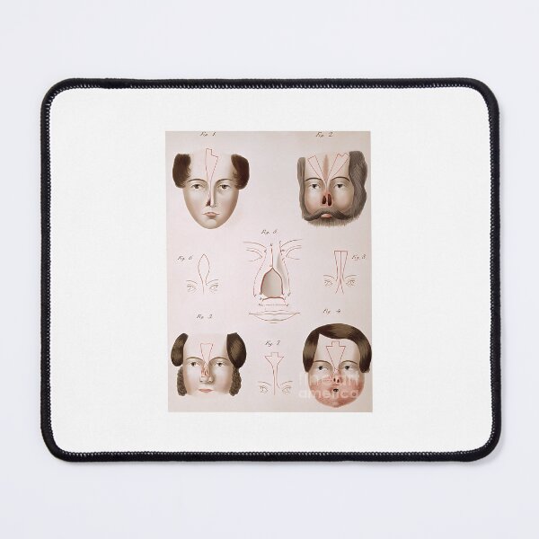 Item preview, nose reconstruction 1815 medical text science source designed and sold by intoreartenss.