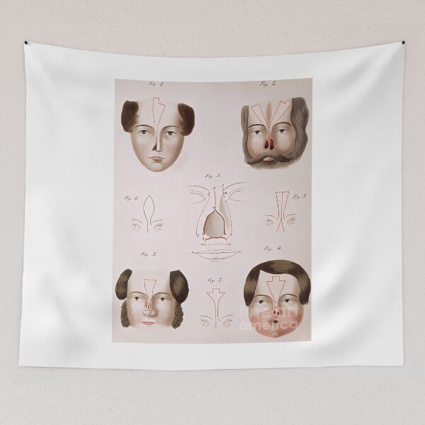 Item preview, nose reconstruction 1815 medical text science source designed and sold by intoreartenss.
