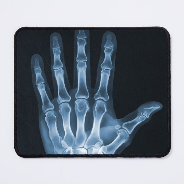 Item preview, X-Ray of the Hand designed and sold by whim-n-wonder.