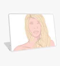 Item Laptop Skin