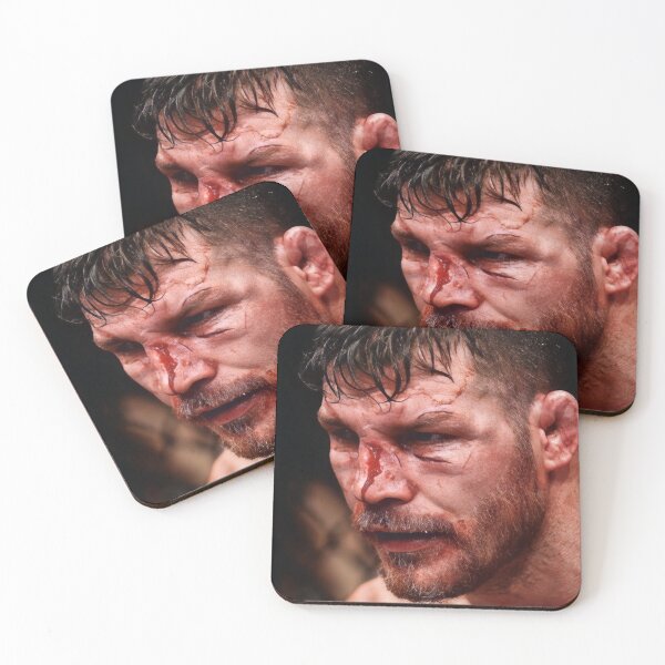 Item preview, Michael Bisping UFC Fighting Michael Bisping Bloody blind Bisping designed and sold by ufcnatediaz.