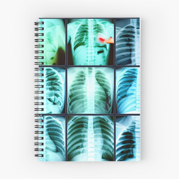 Aperçu de l'œuvre Radiologie / Art de la radiographie créée et vendue par CinderPress.