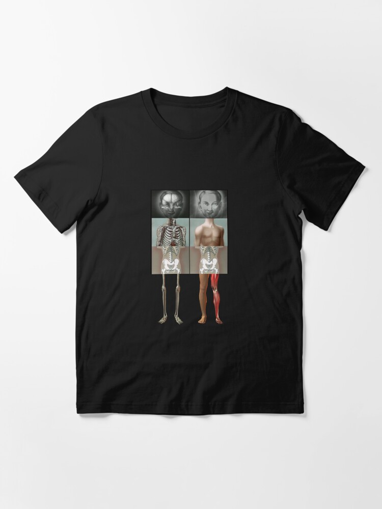 Alternate view of The Twins get new Legs Essential T-Shirt