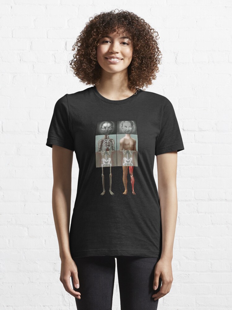 Alternate view of The Twins get new Legs Essential T-Shirt