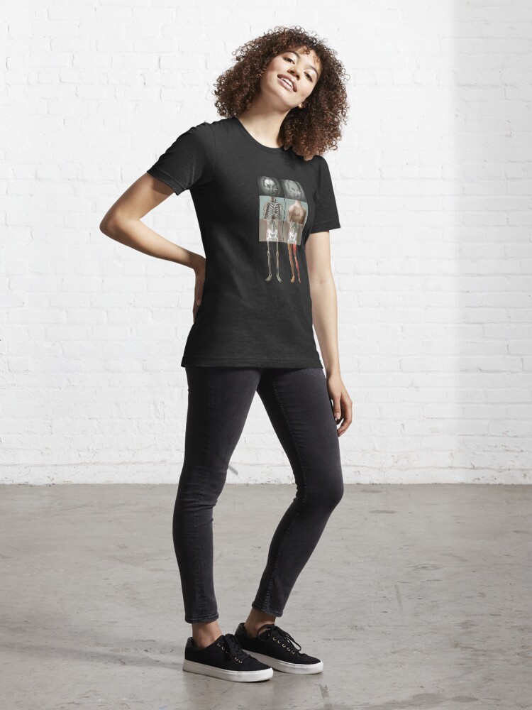 Alternate view of The Twins get new Legs Essential T-Shirt