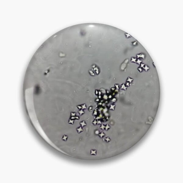 Item preview, Calcium Oxalate Crystals in Urine designed and sold by Panicked Pixie.