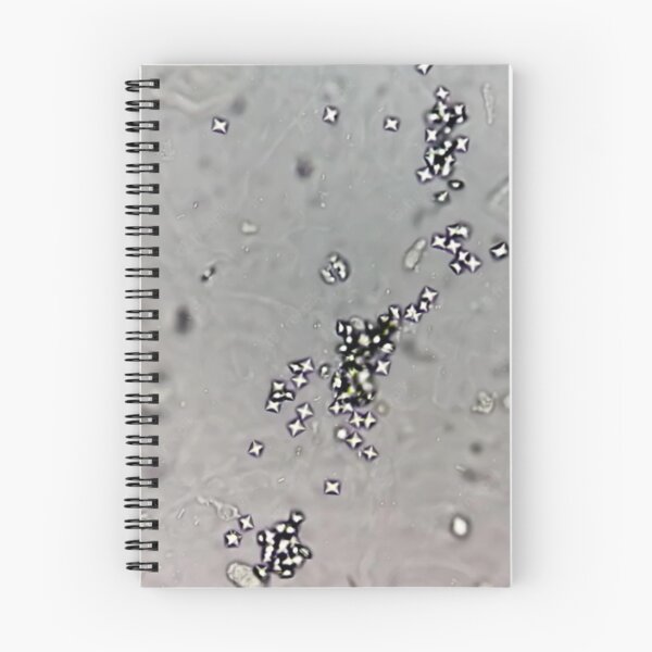 Item preview, Calcium Oxalate Crystals in Urine designed and sold by Panicked Pixie.