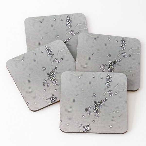 Item preview, Calcium Oxalate Crystals in Urine designed and sold by Panicked Pixie.