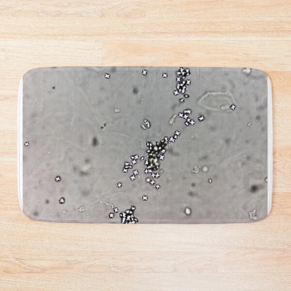 Item preview, Calcium Oxalate Crystals in Urine designed and sold by Panicked Pixie.