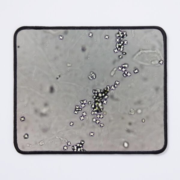 Item preview, Calcium Oxalate Crystals in Urine designed and sold by Panicked Pixie.