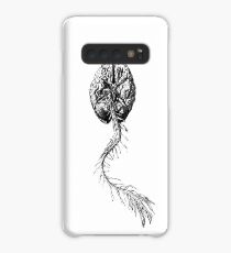 Anatomie des Gehirns Hülle & Klebefolie für Samsung Galaxy