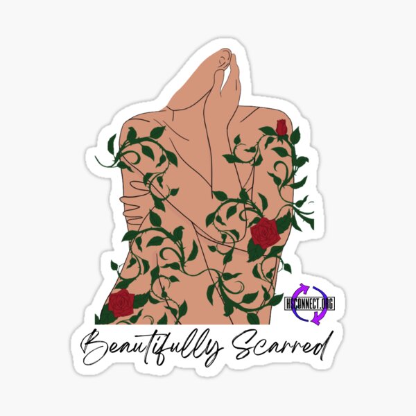 Beautifully Scarred Sticker For Sale By Hsconnectorg Redbubble