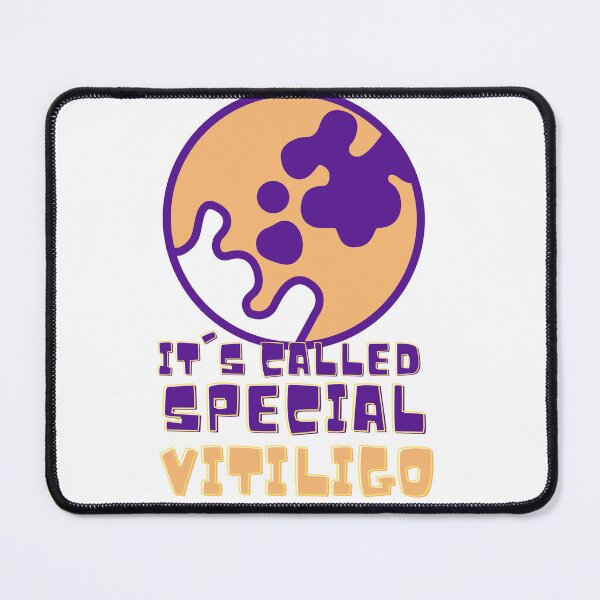 Item preview, It's called special vitiligo designed and sold by RAMS | رامس.