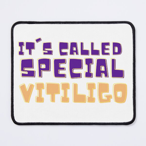 Item preview, It's called special vitiligo you can stop staring now designed and sold by RAMS | رامس.