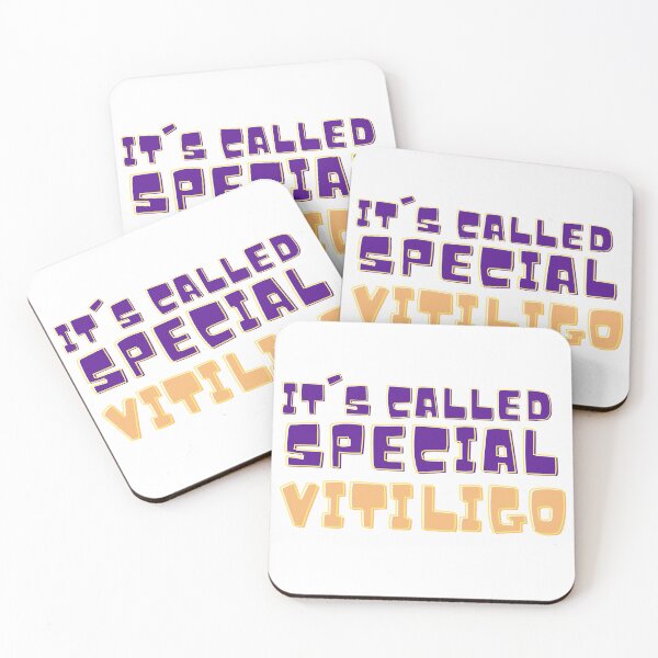 Item preview, It's called special vitiligo you can stop staring now designed and sold by RAMS | رامس.