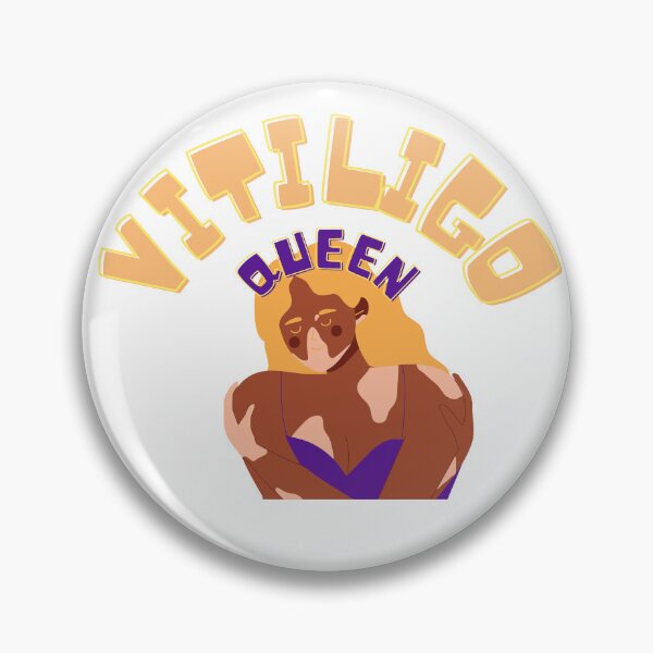 Item preview, It's called special vitiligo queen you can stop staring now  designed and sold by RAMS | رامس.
