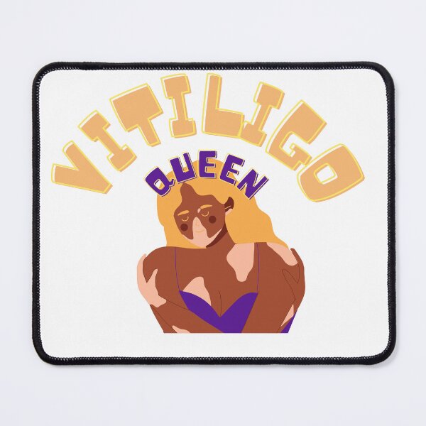 Item preview, It's called special vitiligo queen you can stop staring now designed and sold by RAMS | رامس.