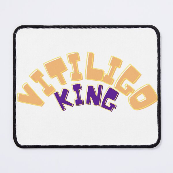 Item preview, It's called special vitiligo king you can stop staring now designed and sold by RAMS | رامس.