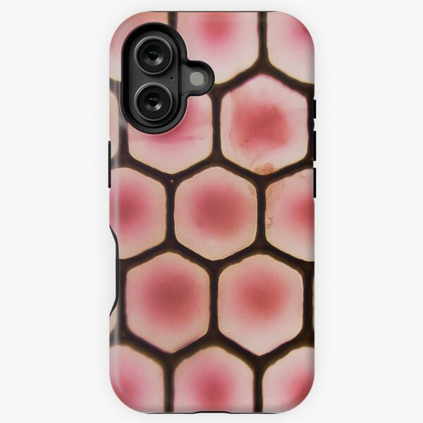 Muscidae - Housefly Eye - Microscopy Photograph iPhone Tough Case