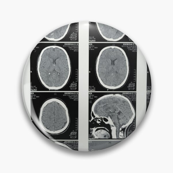 Item preview, Brain MRI designed and sold by brunetteroger99.