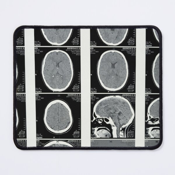 Item preview, Brain MRI designed and sold by brunetteroger99.