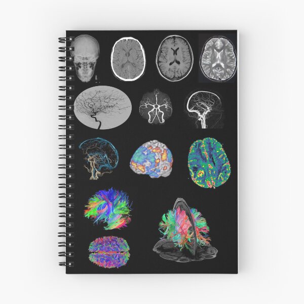 Item preview, Brain Imaging designed and sold by MassimoB.