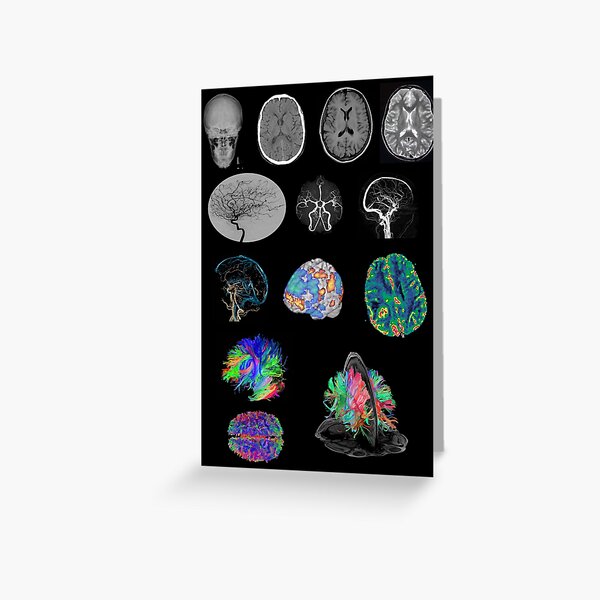 Brain Imaging Greeting Card