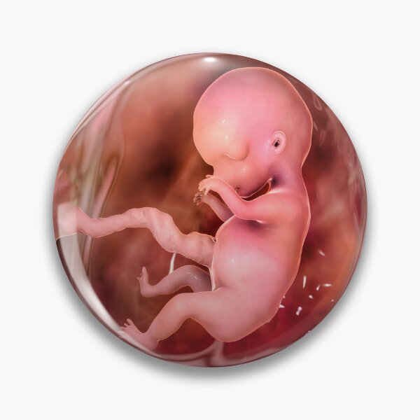 Item preview, Human fetus designed and sold by Kateryna Kon.