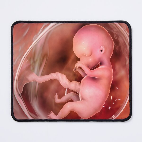 Item preview, Human fetus designed and sold by Kateryna Kon.