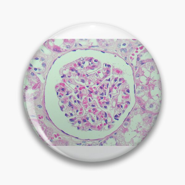 Item preview, Renal corpuscle designed and sold by Damien Harkin.