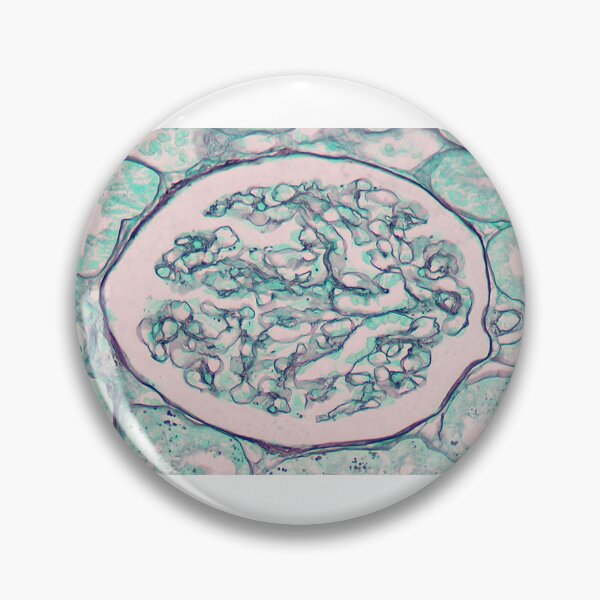 Item preview, Renal corpuscle - Silver stain designed and sold by Damien Harkin.