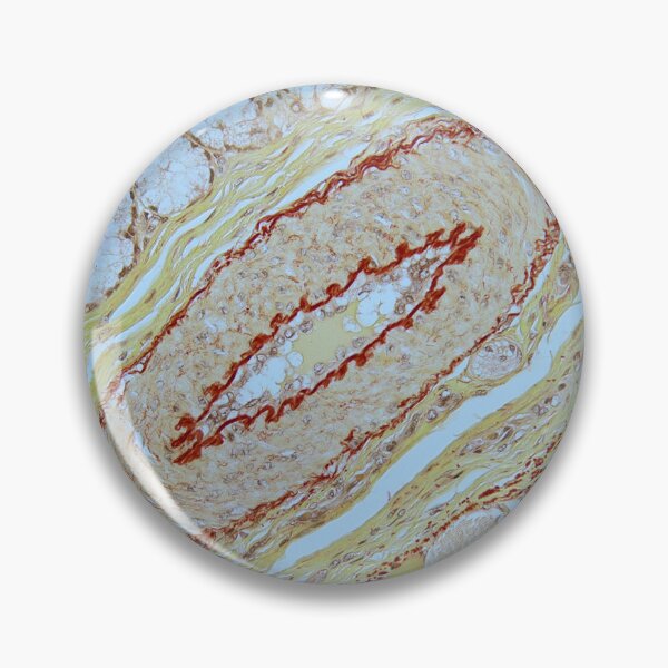 Item preview, Artery - Orcein stain designed and sold by Damien Harkin.