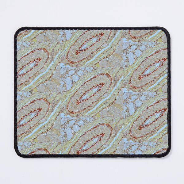 Item preview, Artery - Orcein stain designed and sold by Damien Harkin.