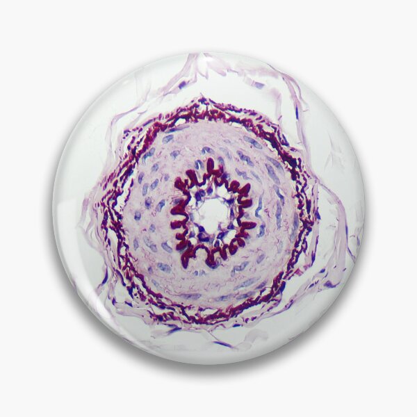 Item preview, Artery - Orcein stain 2 designed and sold by Damien Harkin.