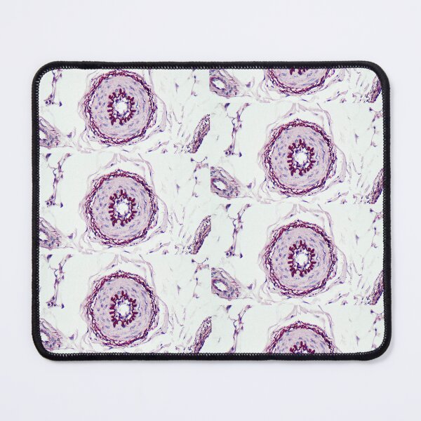 Item preview, Artery - Orcein stain 2 designed and sold by Damien Harkin.