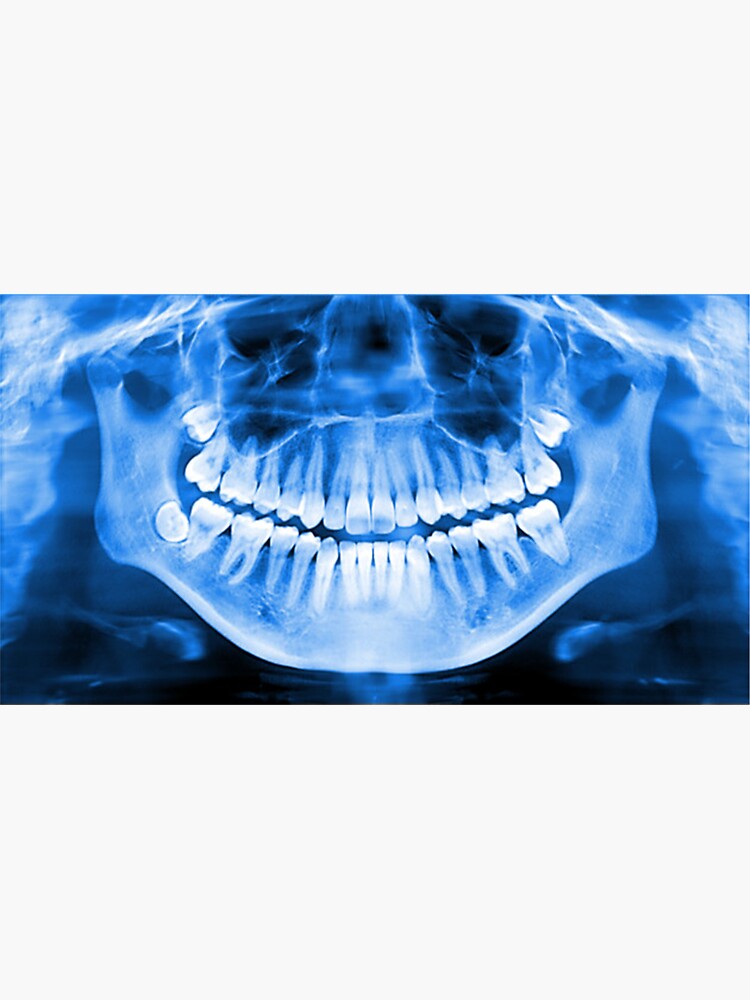 "Dental X Ray" Sticker for Sale by PatFashion Redbubble