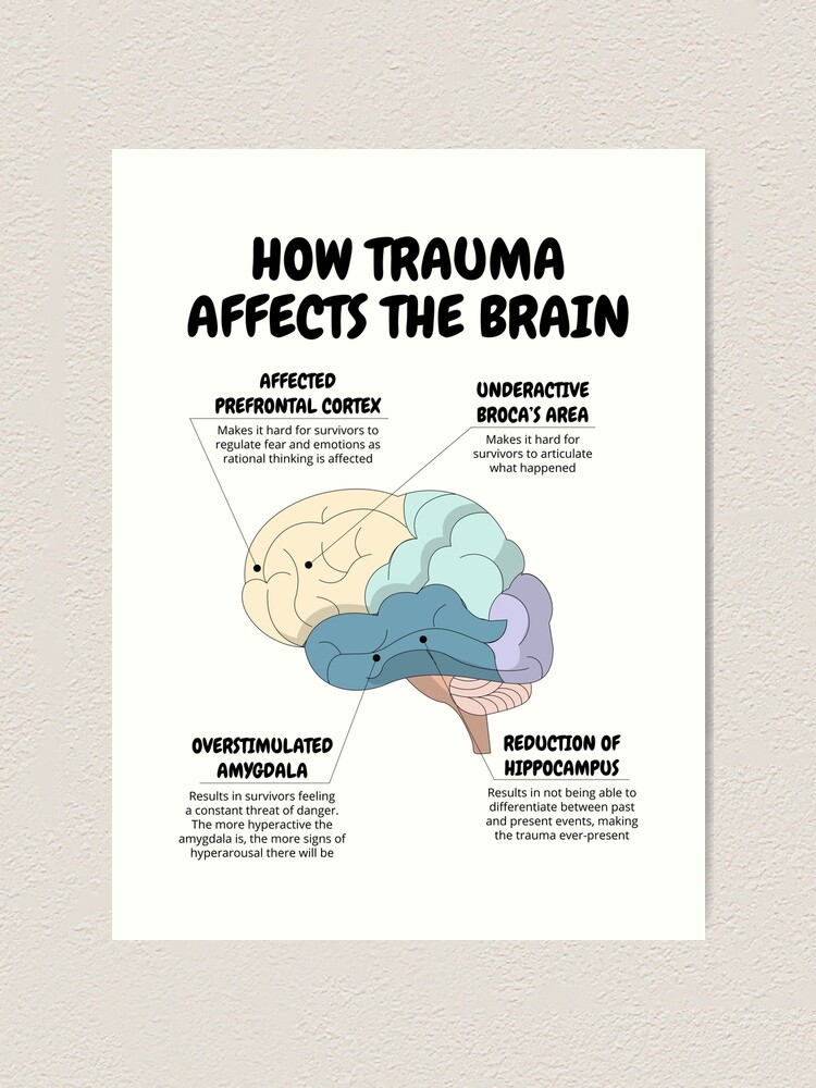 "How Trauma Affects The Brain Therapist Office Decor PTSD Recovery CBT ...