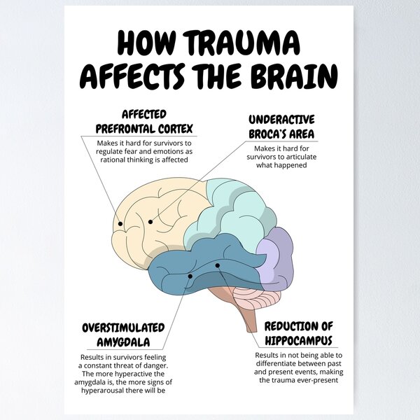 How Trauma Affects The Brain Therapist Office Decor PTSD Recovery CBT DBT Therapy Counseling Aid Social Worker School Psychologist Corner Poster