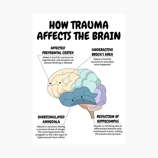 Item preview, How Trauma Affects The Brain Therapist Office Decor PTSD Recovery CBT DBT Therapy Counseling Aid Social Worker School Psychologist Corner designed and sold by Therapy Tools For All.