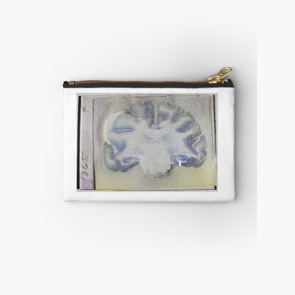 Item preview, Monkey brain slice microscope slide  designed and sold by camillecurious.