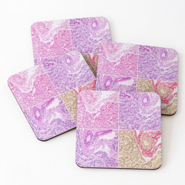 Item preview, Hepatic Montage designed and sold by Damien Harkin.