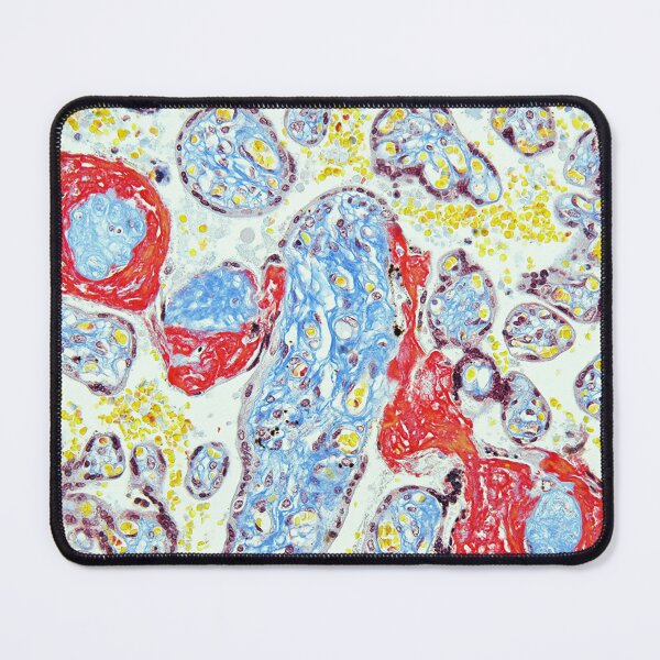 Item preview, Placenta - Trichrome stain designed and sold by Damien Harkin.