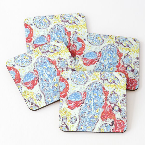 Item preview, Placenta - Trichrome stain designed and sold by Damien Harkin.