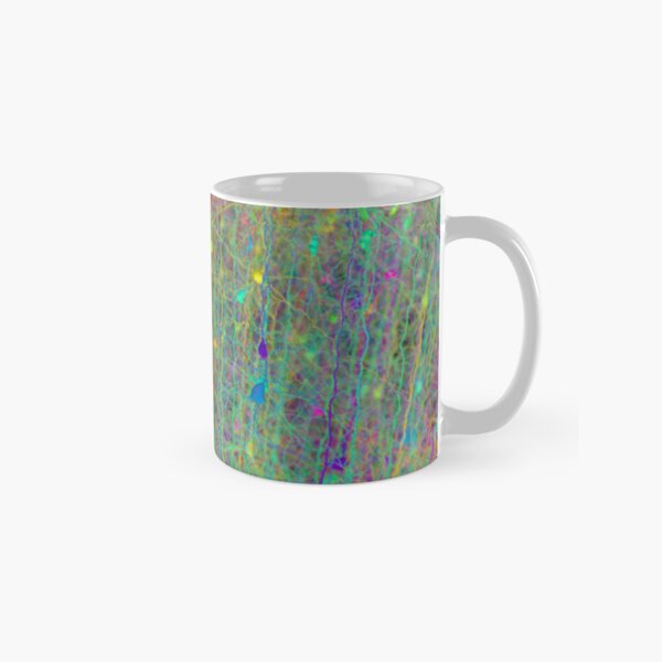 Computer simulation of the branching architecture of the dendrites of pyramidal neurons #Computersimulation #branchingarchitecture #dendrites #pyramidalneurons  Classic Mug