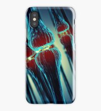 Brain synapses iPhone Case
