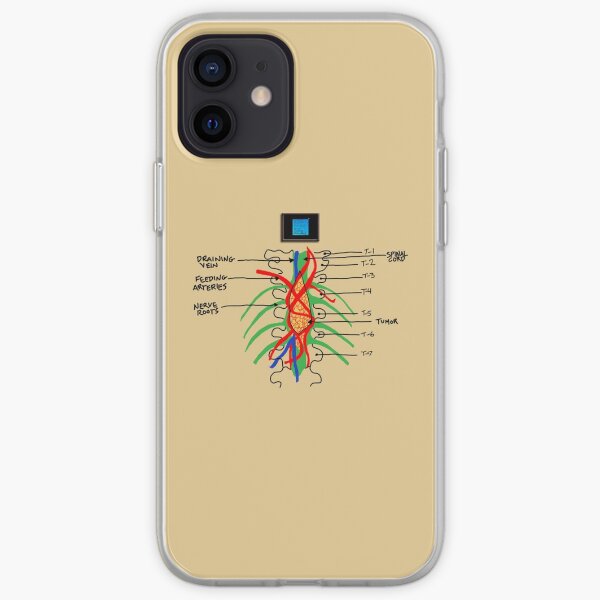 This is Forever iPhone Soft Case
